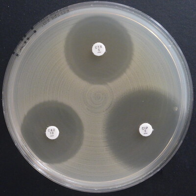 Antimicrobial susceptibility testing Antimicrobial susceptibility testing