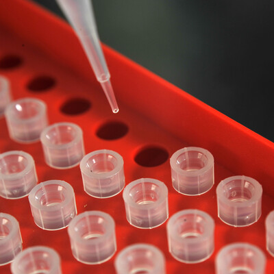 Pipetting in ILRI labs Pipetting in ILRI labs