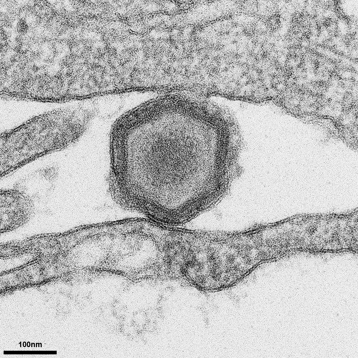 Electron micrograph of ASFV