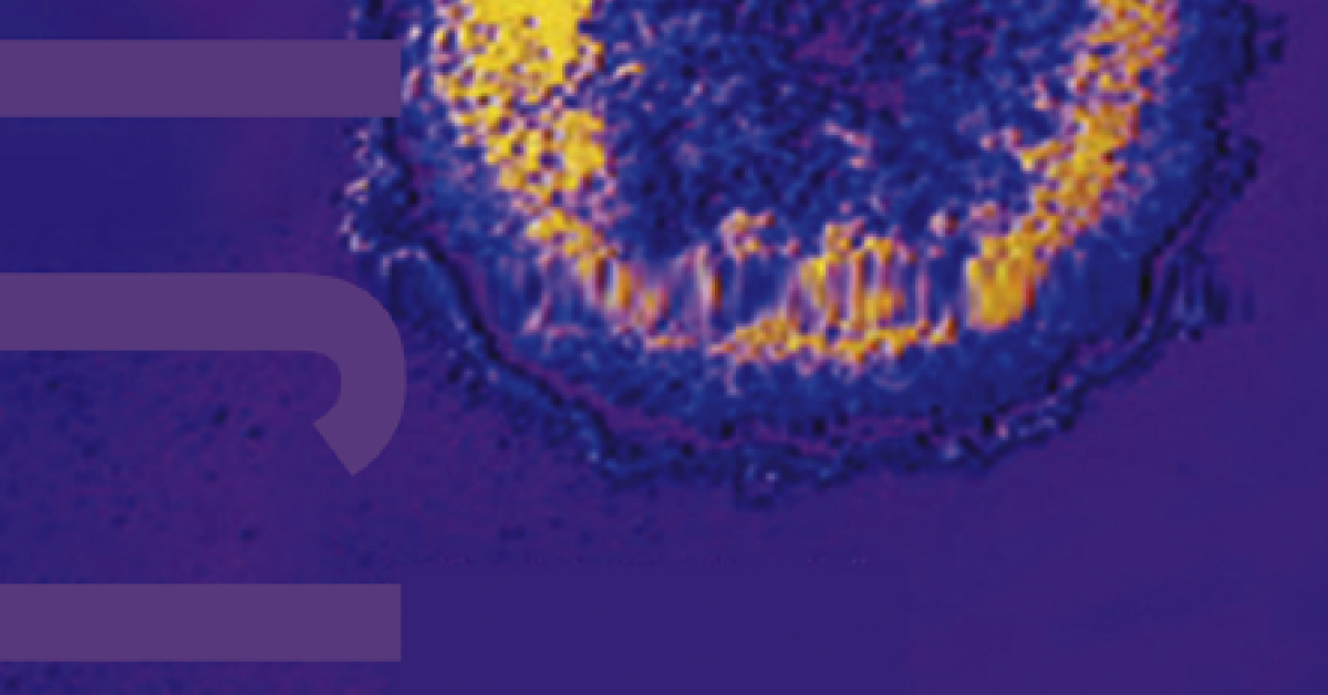 Whole-genome sequencing of SARS-CoV-2 reveals diverse mutations in ...